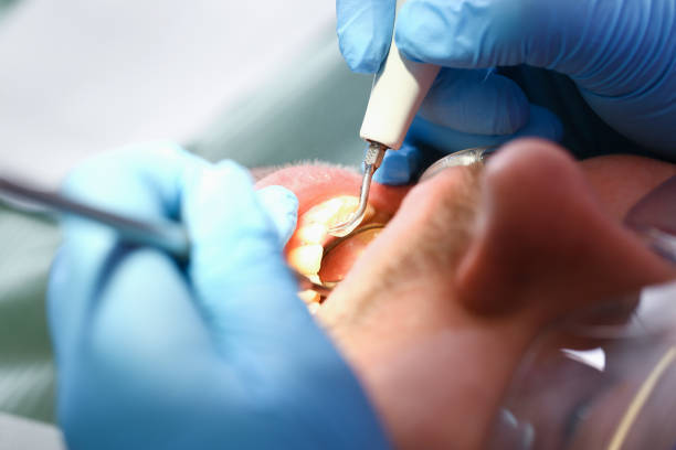 Best Emergency Root Canal Therapy in Bevil Oaks, TX